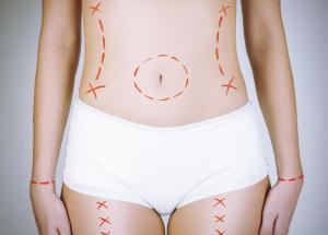 Cirurgia plstica:  possvel fazer mais de uma ao mesmo tempo?