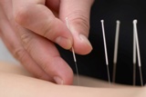 STJ probe psiclogos de usar acupuntura