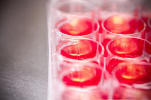 SBTMO emite parecer sobre o armazenamento de sangue de cordo umbilical