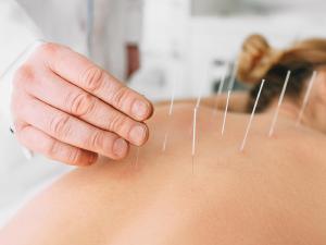 Acupuntura  especialidade e Ato Mdico