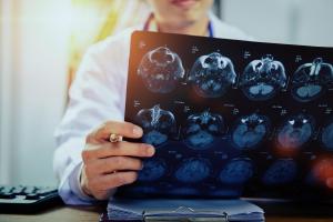 Hospital INC promove simpósio internacional sobre revascularização cerebral e prevenção do AVC