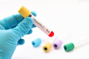 Ministrio da Sade investiga 72 casos suspeitos de hepatite misteriosa no Brasil