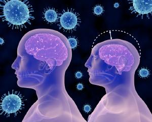 Brasil adota recomendao da OMS e reduz medida para microcefalia