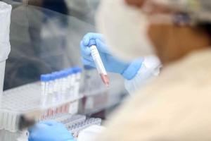 Paran registra 178 bitos em uma dia, maior nmero pela Covid-19 desde janeiro