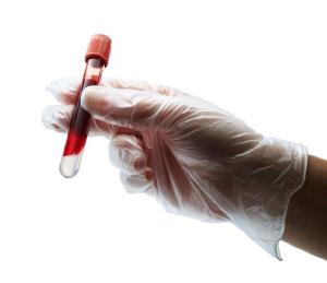 Servios de hemoterapia: confira nota tcnica